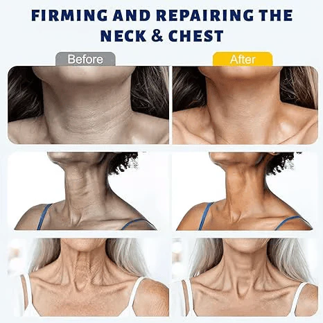✨ Fluffpurewash™ Instant Neck Lift Cream — 🧴 Infused with Retinol & Hyaluronic Acid | Firms the Neck, Reduces Wrinkles