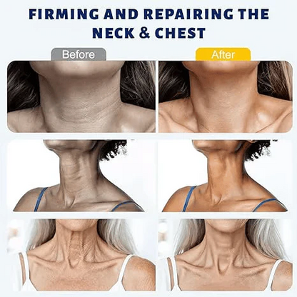 ✨ Fluffpurewash™ Instant Neck Lift Cream — 🧴 Infused with Retinol & Hyaluronic Acid | Firms the Neck, Reduces Wrinkles