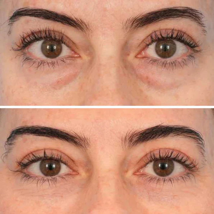 🔥LAST DAY 50% OFF - Deep Peptide Collagen Eye Mask