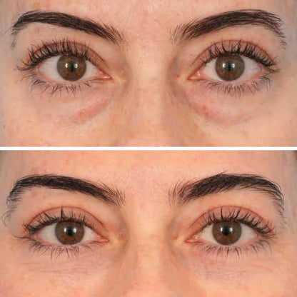 🔥LAST DAY 50% OFF - Deep Peptide Collagen Eye Mask