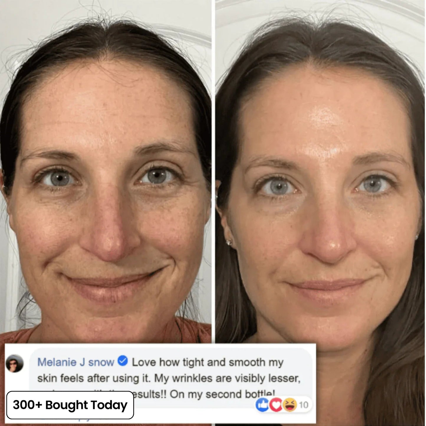Klyvena customer skincare result