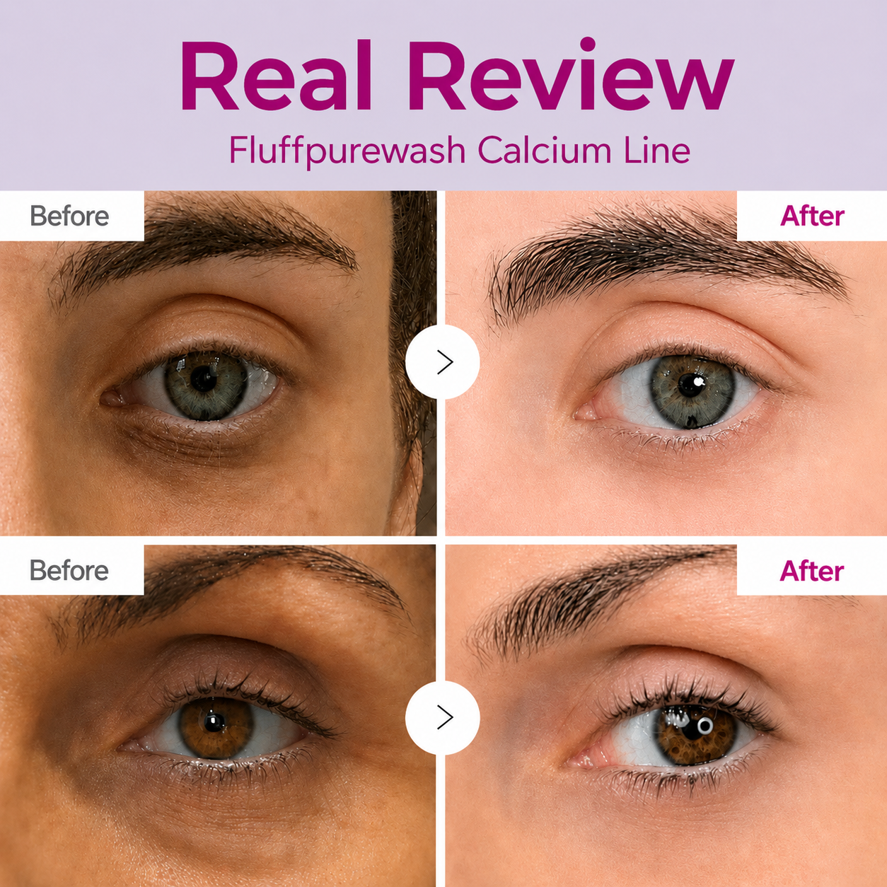 🔥LAST DAY 50% OFF - Fluffpurewash Korean Calcium Dark Spot Eye Cream
