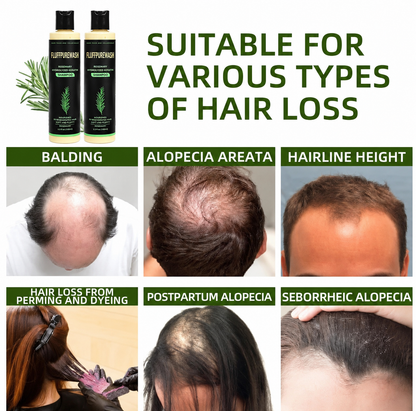 🔥LAST DAY 80% OFF - 🌿Fluffpurewash® Organic Rosemary Hair Growth Shampoo