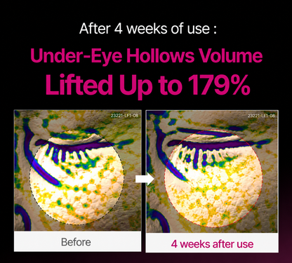 🔥LAST DAY 50% OFF - Fluffpurewash Korean Calcium Dark Spot Eye Cream