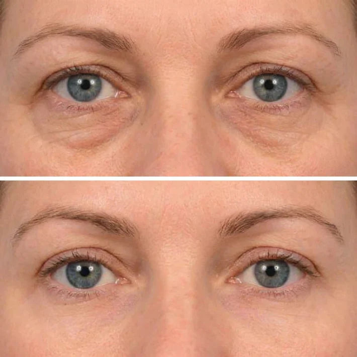 🔥LAST DAY 50% OFF - Deep Peptide Collagen Eye Mask