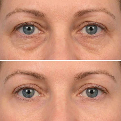 🔥LAST DAY 50% OFF - Deep Peptide Collagen Eye Mask
