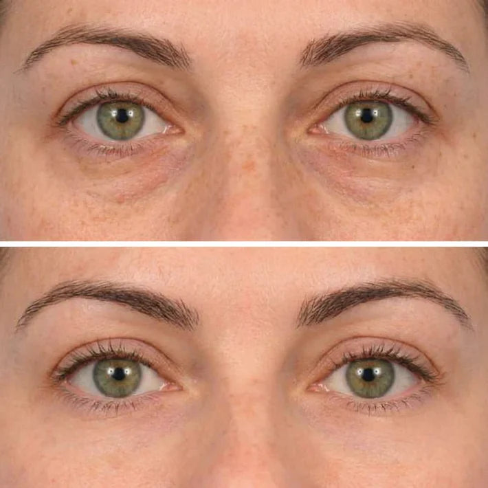 🔥LAST DAY 50% OFF - Deep Peptide Collagen Eye Mask