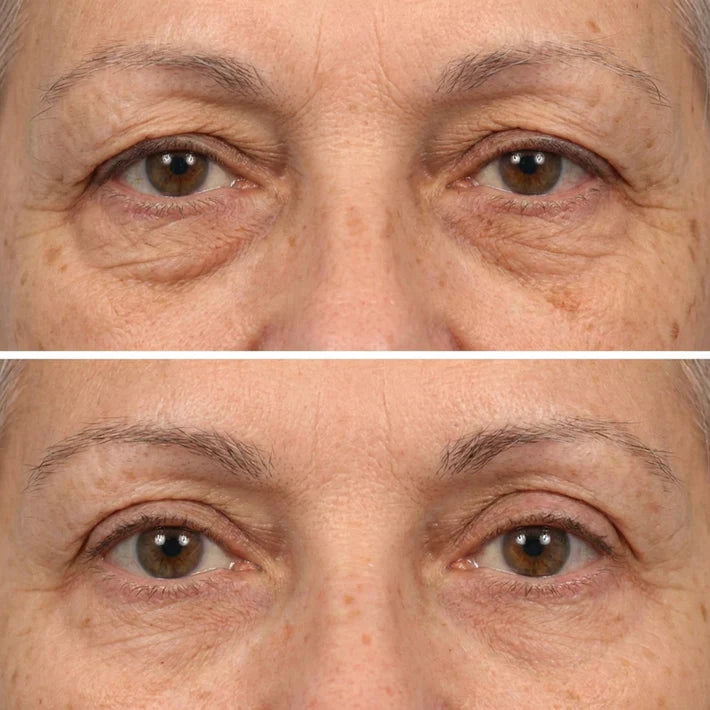 🔥LAST DAY 50% OFF - Deep Peptide Collagen Eye Mask