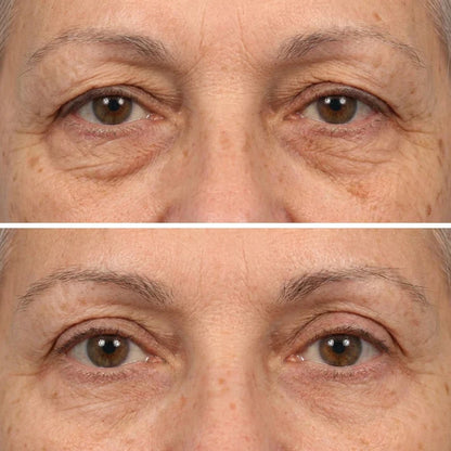 🔥LAST DAY 50% OFF - Deep Peptide Collagen Eye Mask