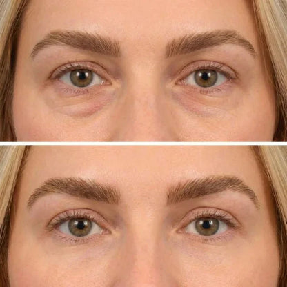 🔥LAST DAY 50% OFF - Deep Peptide Collagen Eye Mask