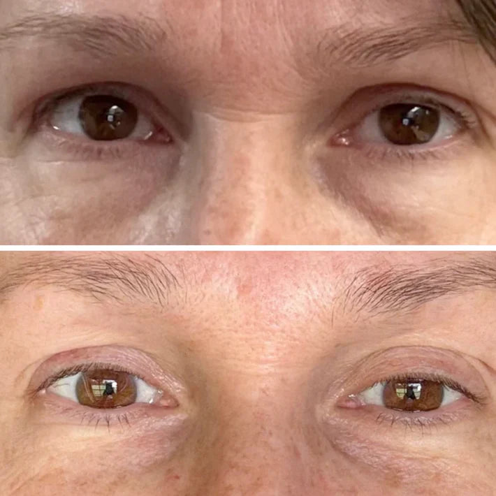 🔥LAST DAY 50% OFF - Deep Peptide Collagen Eye Mask